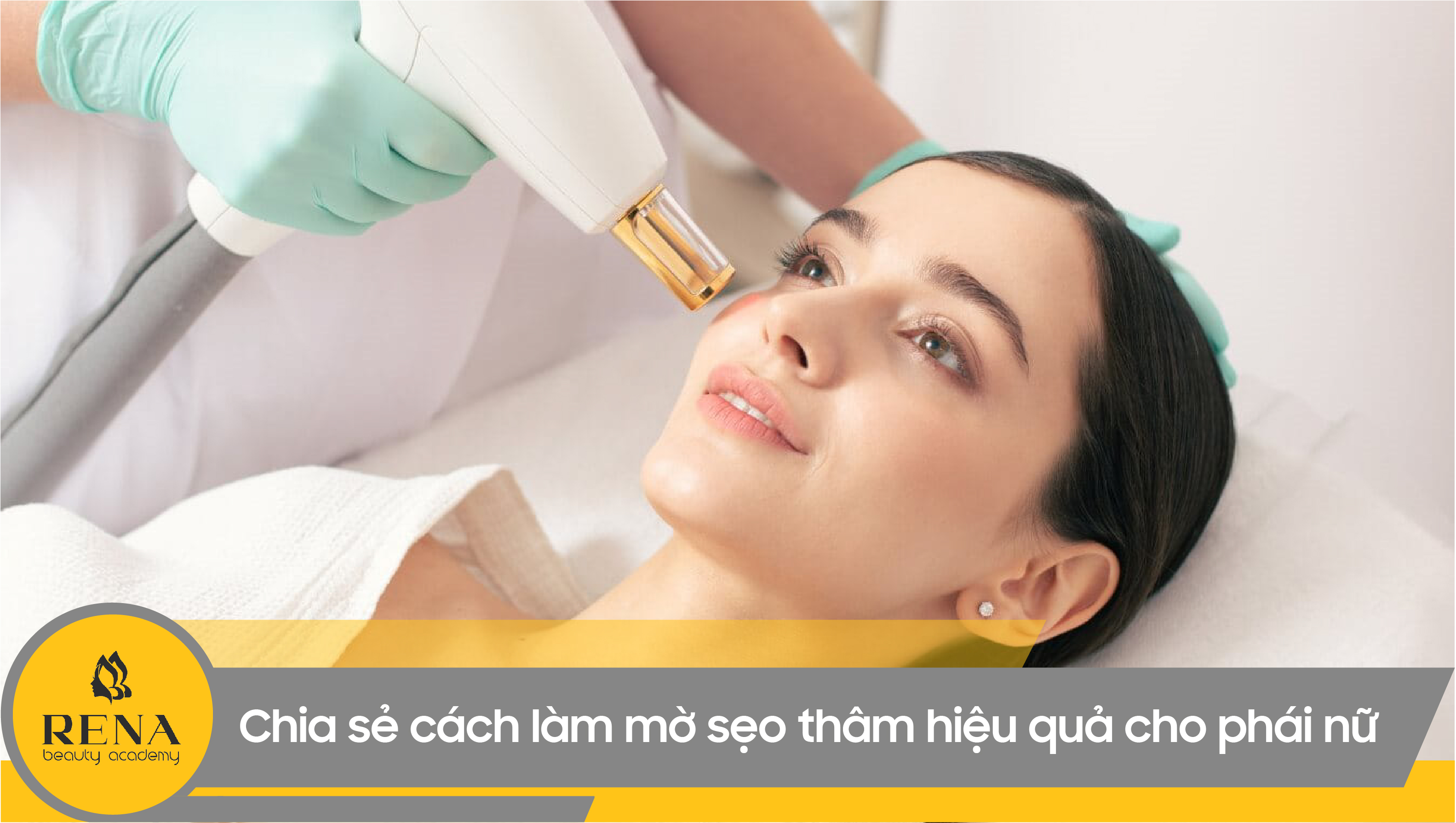 Chia sẻ cách làm mờ sẹo thâm hiệu quả cho phái nữ