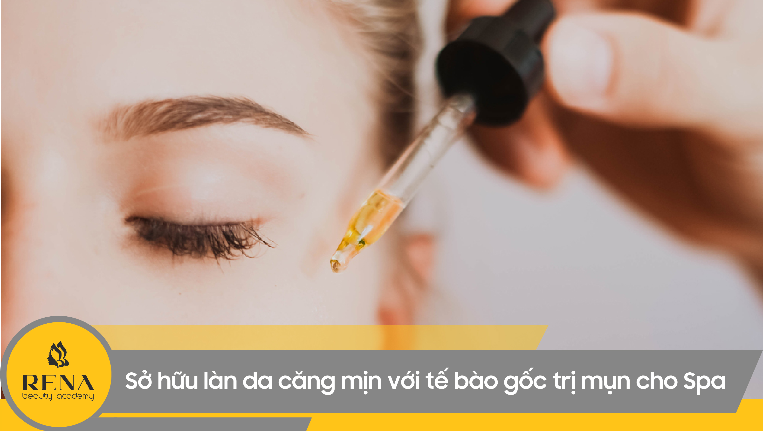 Sở hữu làn da căng mịn với tế bào gốc trị mụn cho Spa